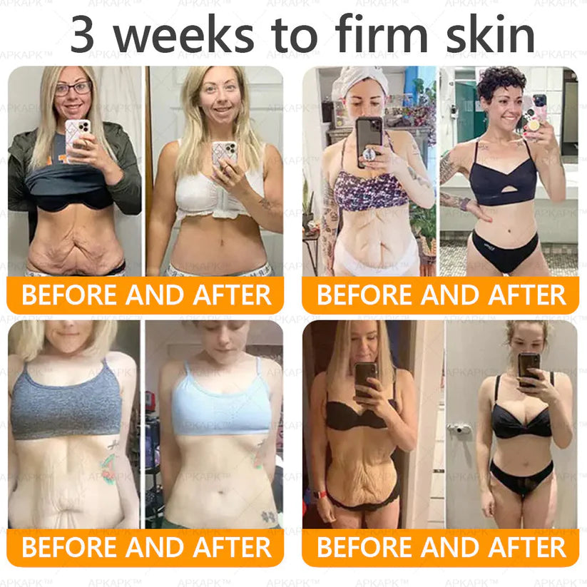 🔥Buy one get one free🔥BeeRx™ Cream |