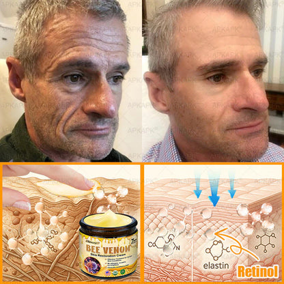 🔥Buy one get one free🔥BeeRx™ Cream |