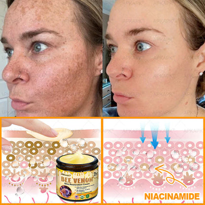 🔥Buy one get one free🔥BeeRx™ Cream |