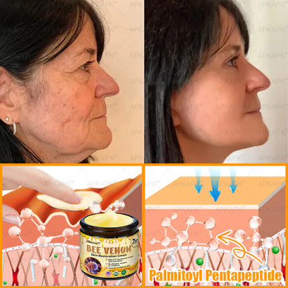 🔥Buy one get one free🔥BeeRx™ Cream |