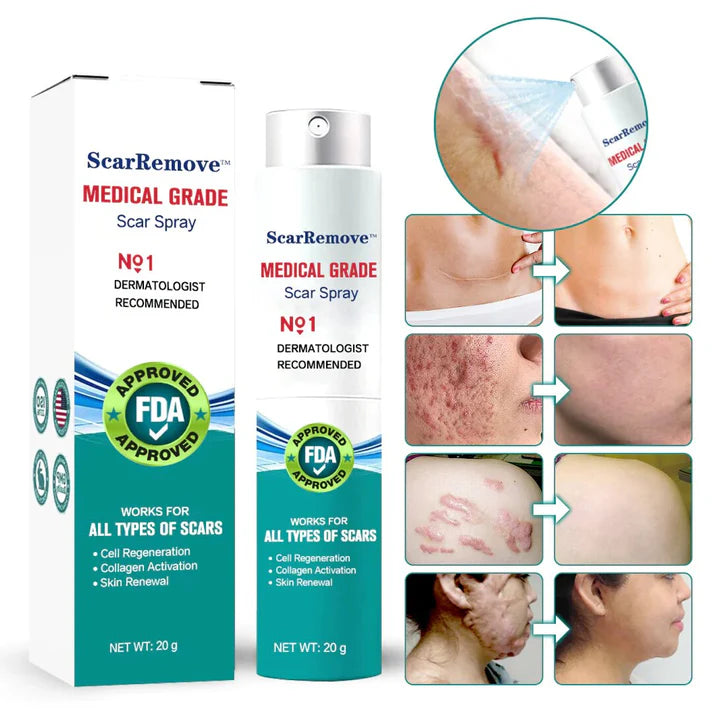 🔥Buy 3 Get 3 Free🔥Advanced ScarRemoval Spray