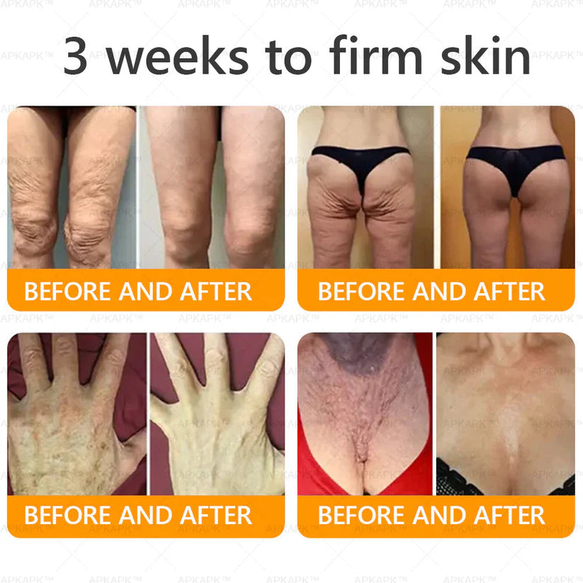 🔥Buy one get one free🔥BeeRx™ Cream |