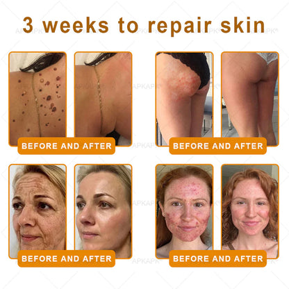 🔥Buy one get one free🔥BeeRx™ Cream |