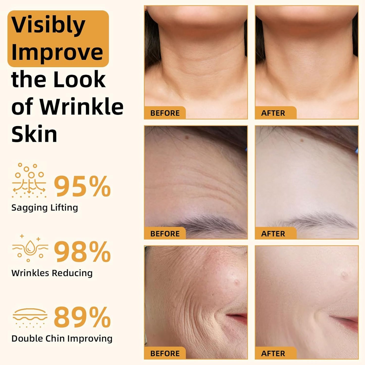 🔥Buy 2 Get 1 Free🔥2025 New Instant Botoxin Bee Venom Firming Anti-Aging Wrinkle Removal Cream