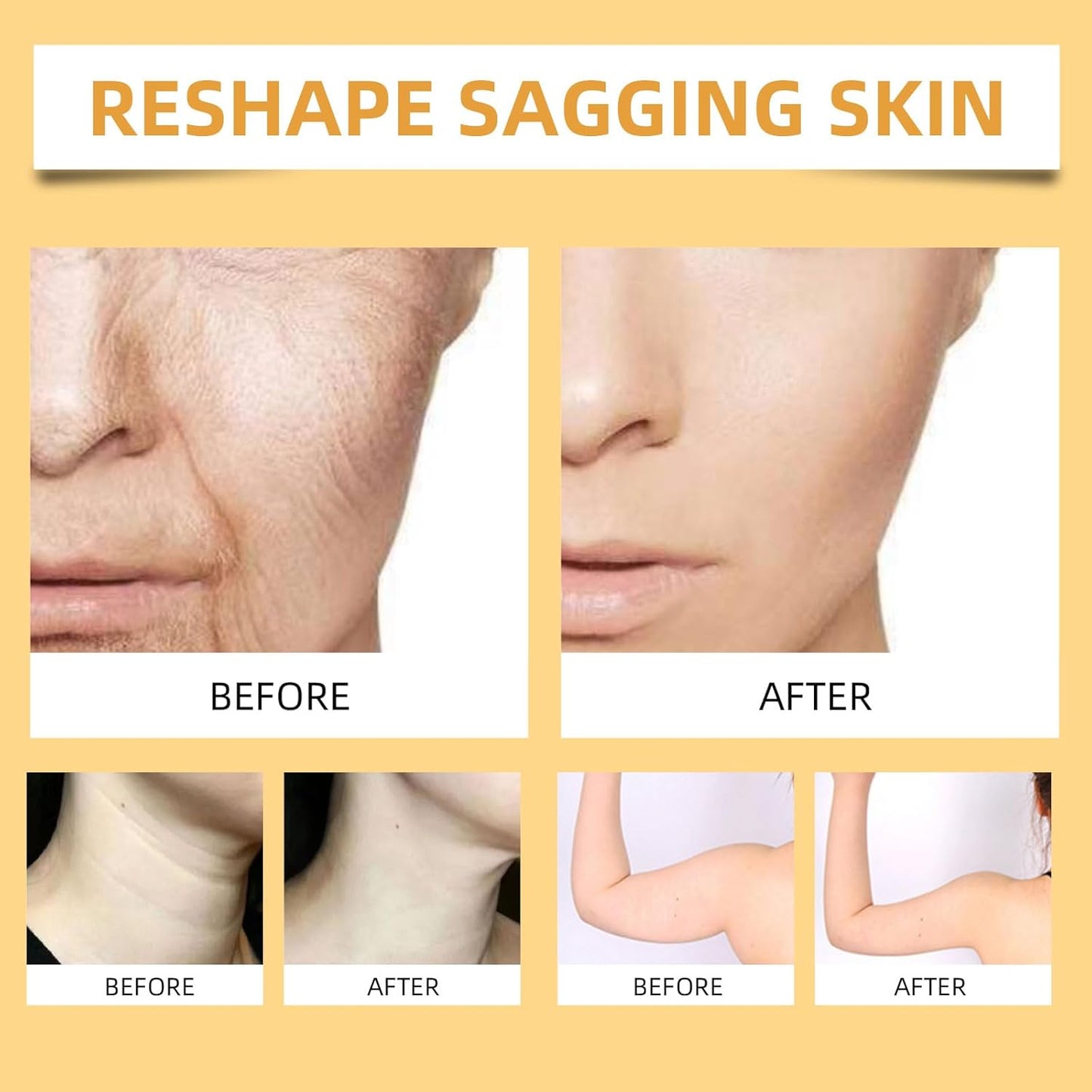 🔥Buy 2 Get 1 Free🔥2025 New Instant Botoxin Bee Venom Firming Anti-Aging Wrinkle Removal Cream